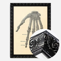 Vintage Medical Skeleton Hand Illustration Print