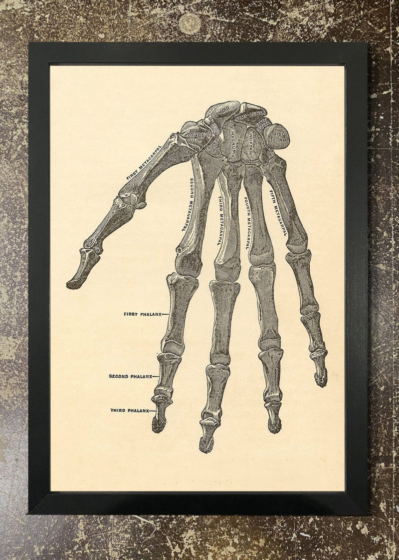 Skeleton Hand Diagram - Framed 21x30cm Print